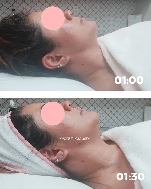 Before and after