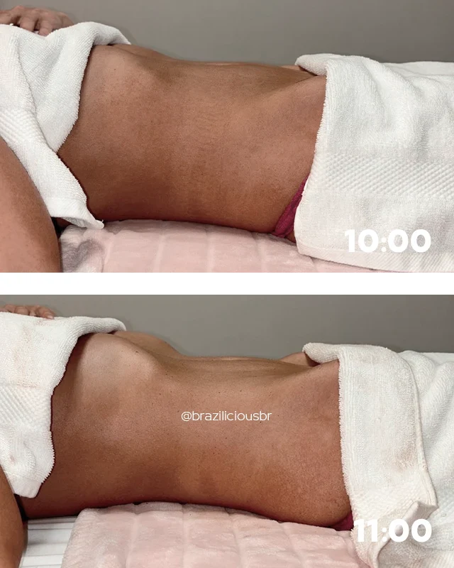 Before and after