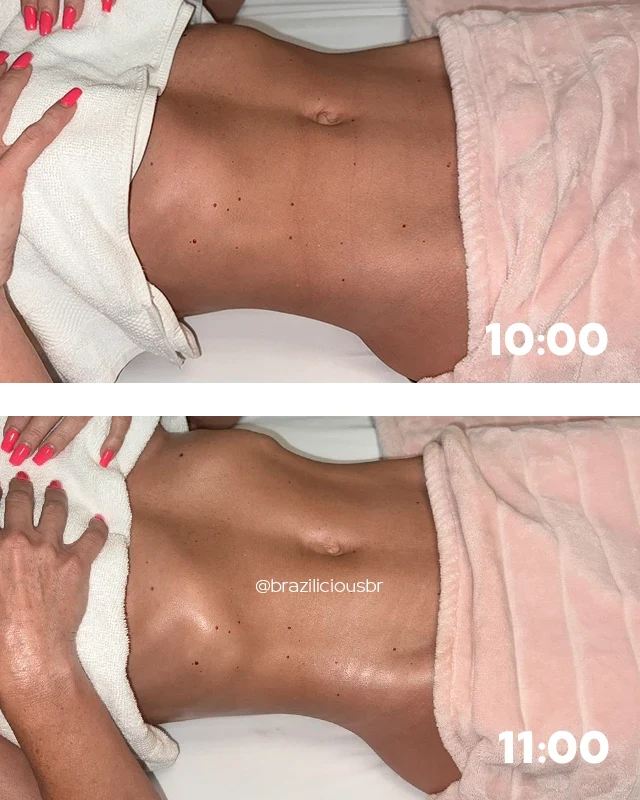 Before and after