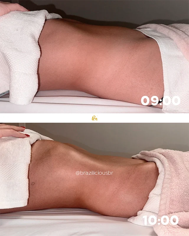 Before and after