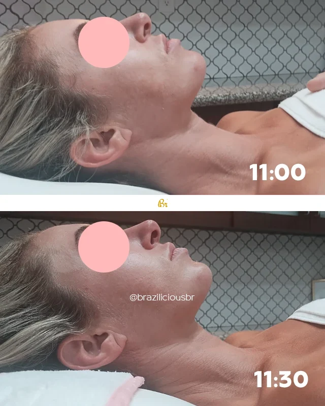 Before and after