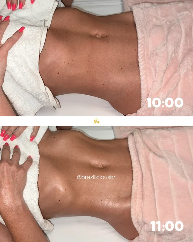 Before and after