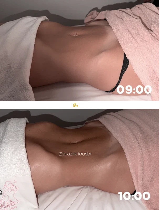 Before and after