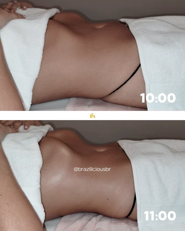 Before and after