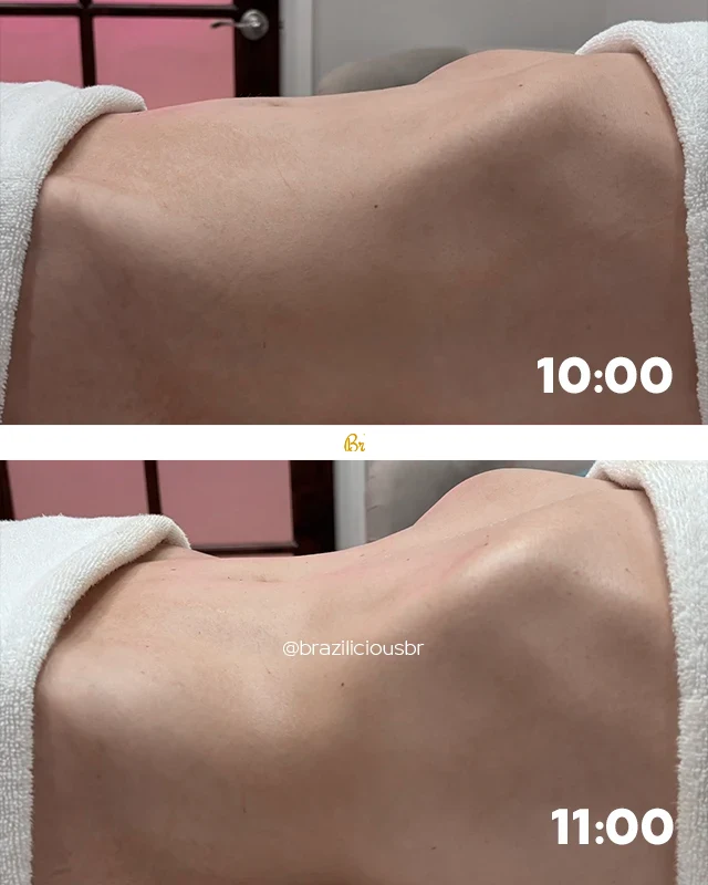 Before and after