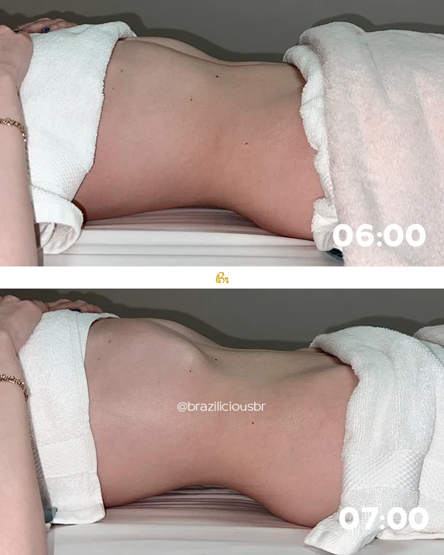Before and after
